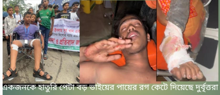 ভাইকে হাতুড়িপেটা, বিচার চাওয়ায় বড় ভাইয়ের পায়ের রগ কেটে দিল দূর্বৃত্তরা