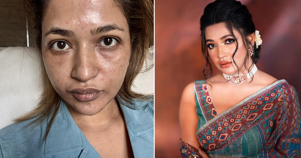 আমি অনেক ‘ট্রমা’ বয়ে বেড়াই : বাঁধন