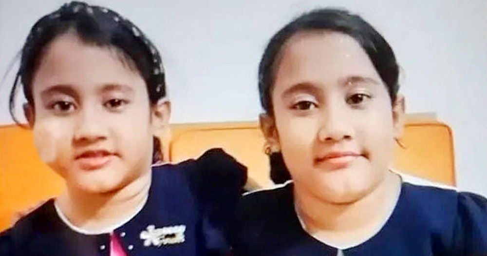 সিসিইউতে যন্ত্রণায় কাতরাচ্ছে সারিনা-সাইবা যমজ দুই বোন