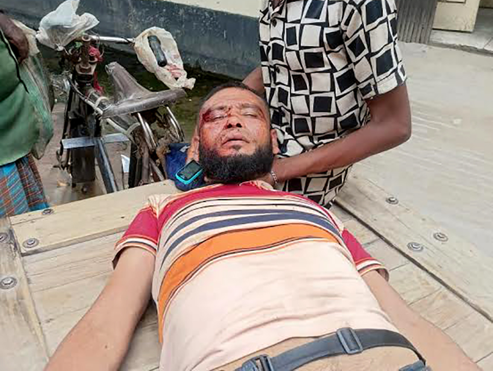 যশোরের অভয়নগরে জমি নিয়ে বিরোধের জেরে হামলা, আহত ১