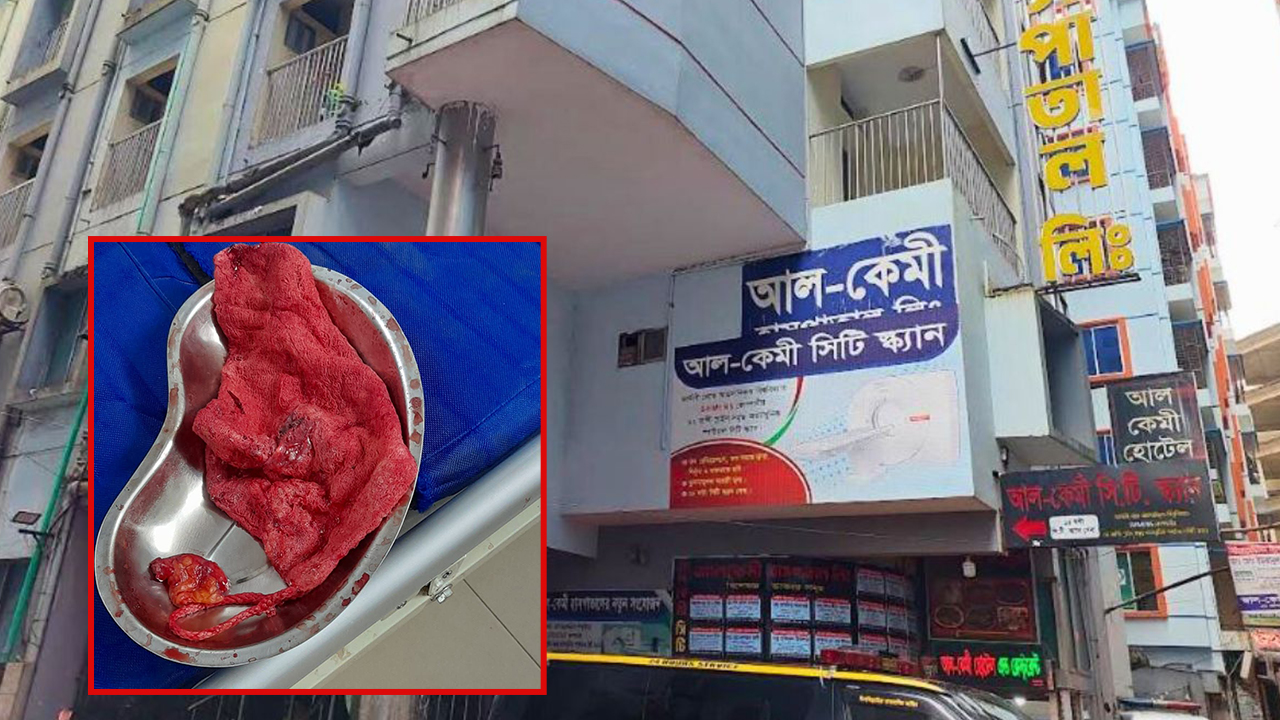 অস্ত্রোপচারের ভুল, ৭ মাস পর নারীর পেটে ধরা পড়ল গজ কাপড়