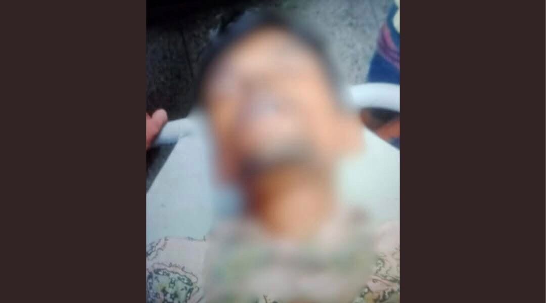 চট্টগ্রামের পটিয়ায় ছিনতাইকারীর ছুরিকাঘাতে রিক্সা চালক খুন