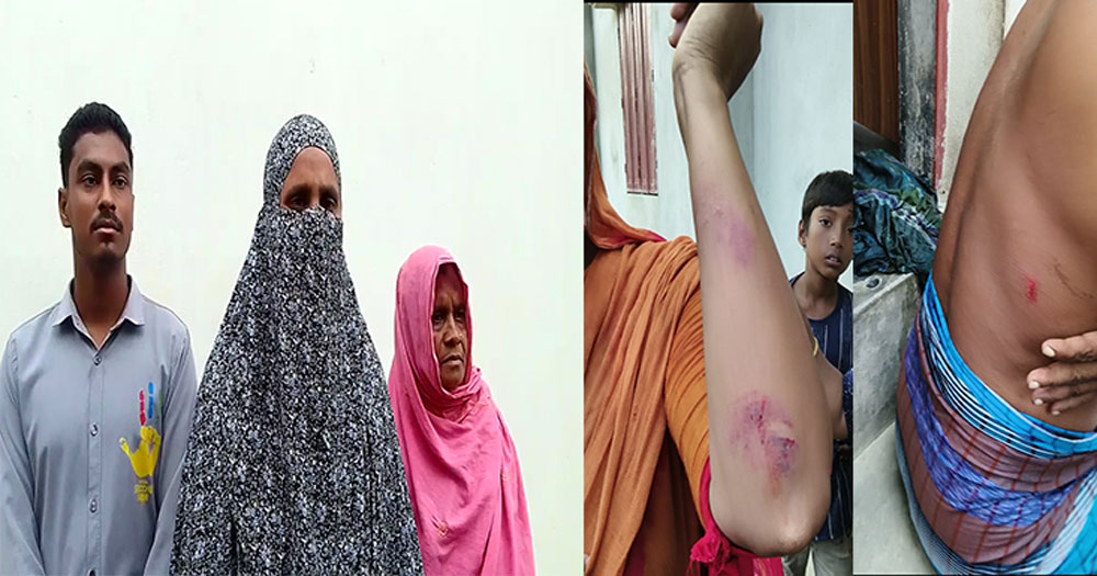 আ.লীগ নেতার কু-প্রস্তাবে রাজি না হওয়ায় প্রবাসীর স্ত্রীকে মারধরের অভিযোগ