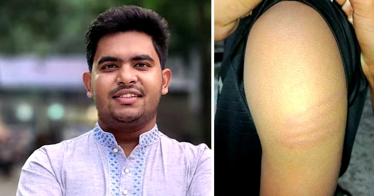 ফেল করা অর্ধশত শিক্ষার্থীকে পেটালেন বাগছাস নেতা