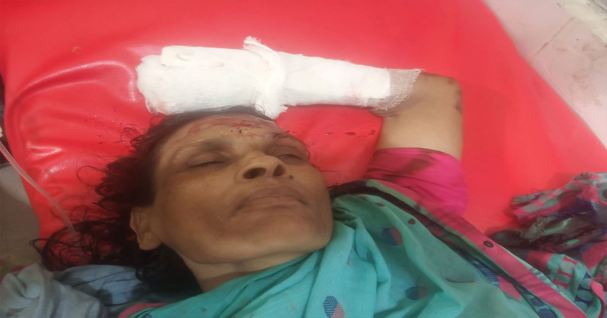 লালপুরে ট্রেনে কাটা পড়ে নারী আহত