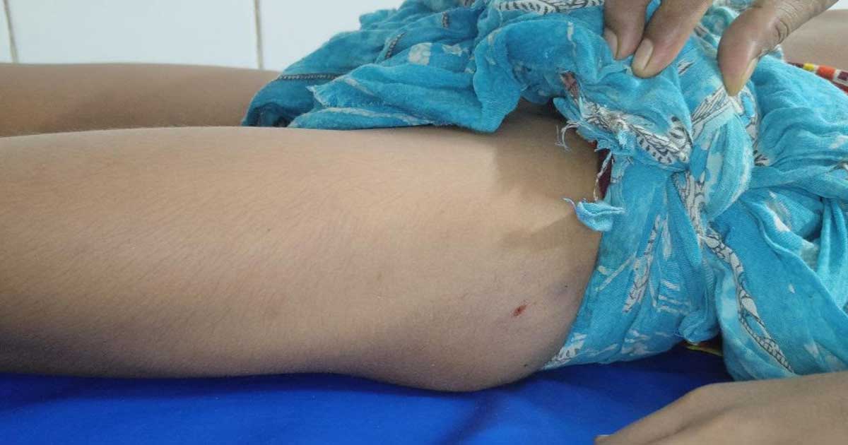 ইসলামপুরে সাপের কামড়ে শিশুর মৃত্যু