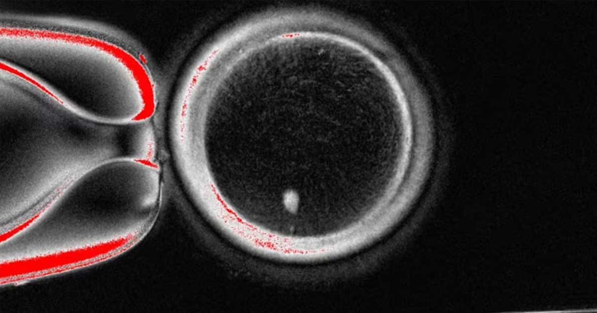মানব ত্বকের ডিএনএ থেকে ভ্রূণ তৈরি করলেন বিজ্ঞানীরা