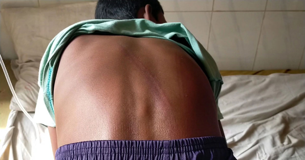 গাংনীতে মাদ্রাসা শিক্ষার্থীকে পিটিয়ে জখম করেছে শিক্ষক