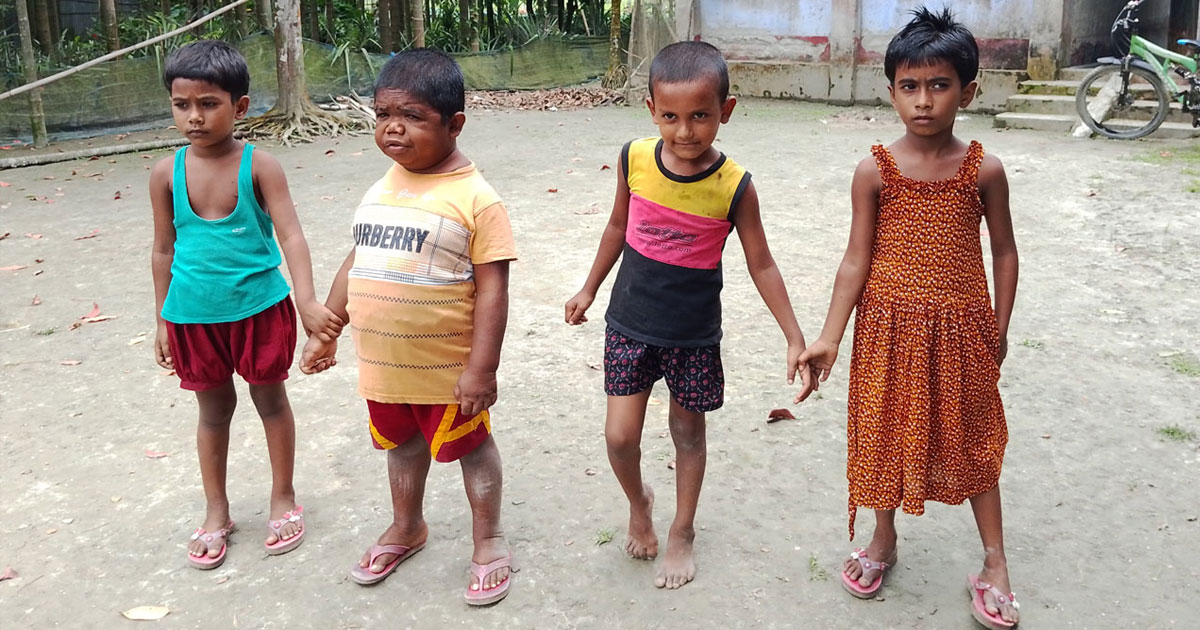 ৩৩ বছরের ছমির এখনও শিশু!