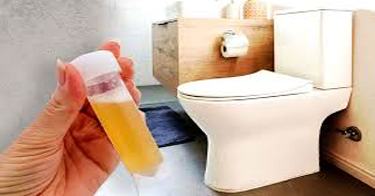 প্রস্রাবে অতিরিক্ত ফেনা কি কিডনি বিকল হওয়ার লক্ষণ?