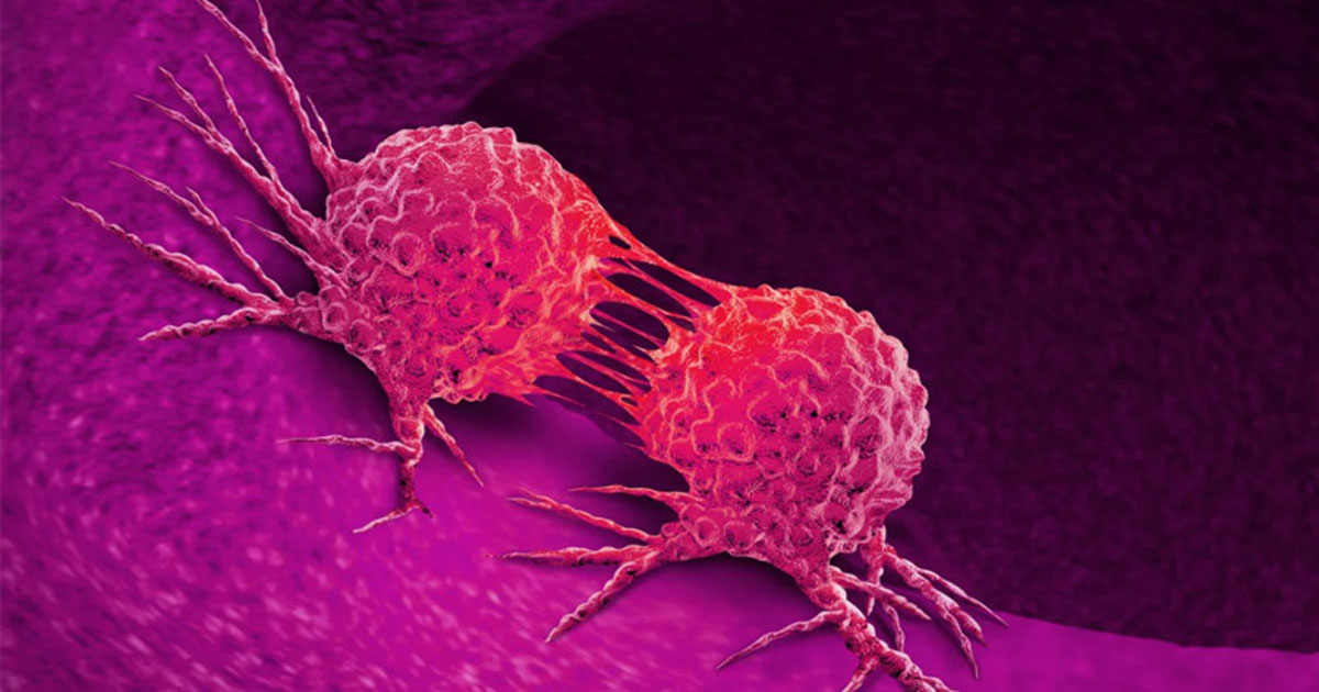 নীরবে শরীরে বাসা বাঁধে নেট ক্যানসার