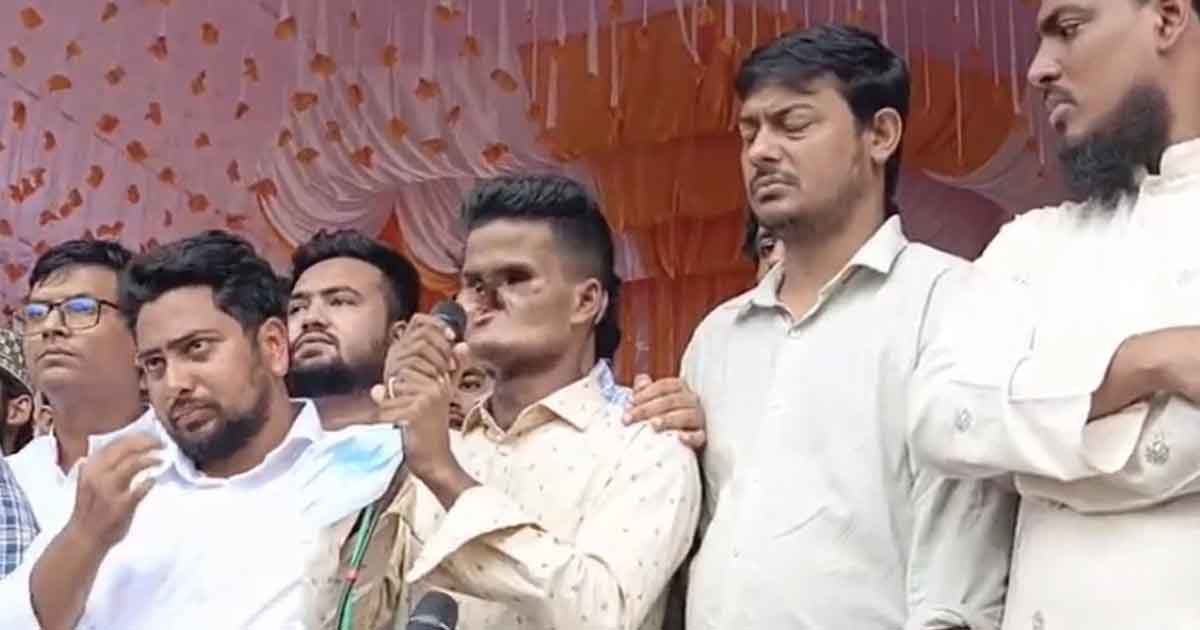 জুলাই আন্দোলনে মুখমণ্ডল হারানো নিরপরাধ খোকন এনসিপির প্রার্থী