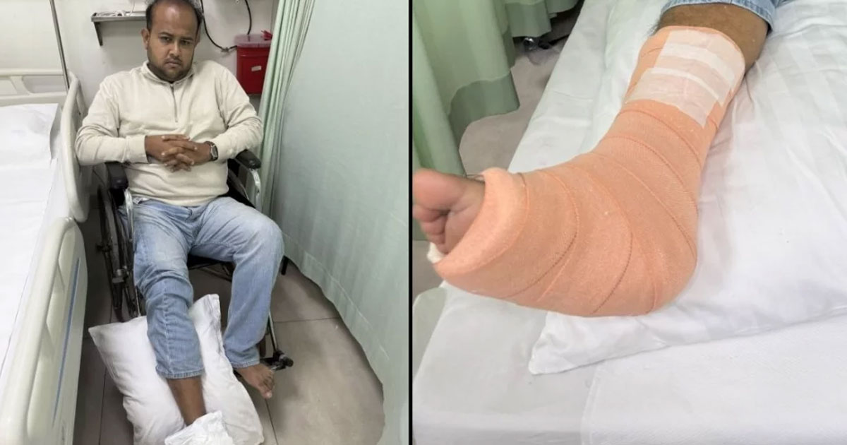 সিঁড়ি দিয়ে নামতে গিয়ে পা ভাঙলেন ঢাবি ছাত্রদল নেতা হামীম