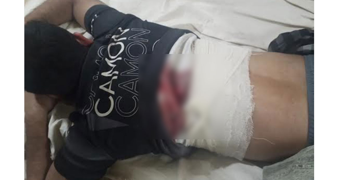 নোয়াখালীতে ব্যবসায়ীকে গুলি করে মোটরসাইকেল ছিনতাই
