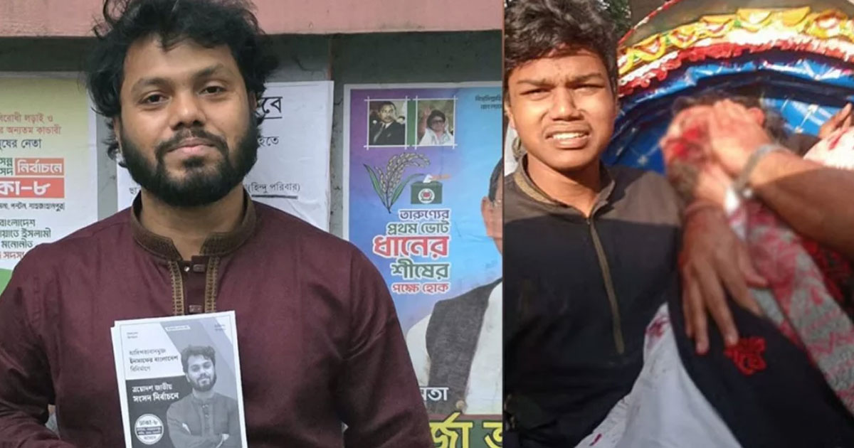 ওসমান হাদির অবস্থা সম্পর্কে যা জানালেন চিকিৎসক