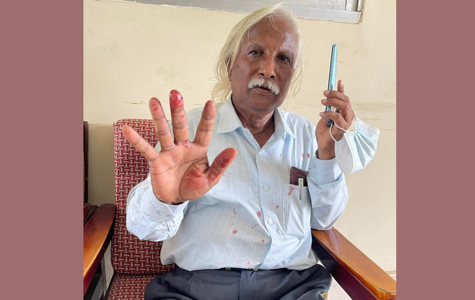 নোয়াখালীতে সাম্যবাদী আন্দোলনের নেতাকর্মিদের ওপর হামলা, আহত ৫