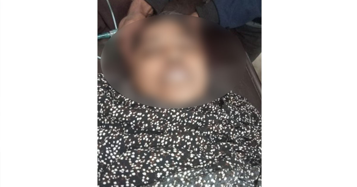 যশোরে ইজিবাইকের চাকার সঙ্গে ওড়না পেঁচিয়ে নারীর মৃত্যু