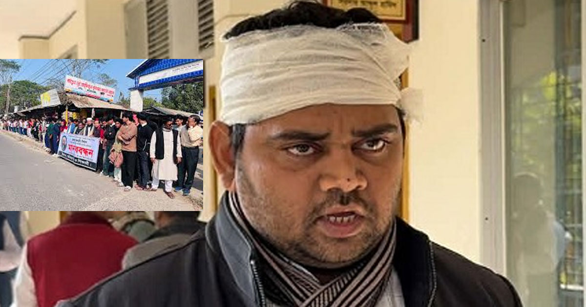 মাদারীপুরে স্কুলে ঢোকার পথে শিক্ষককে হাতুড়ি দিয়ে হামলা, প্রতিবাদে মানববন্ধন
