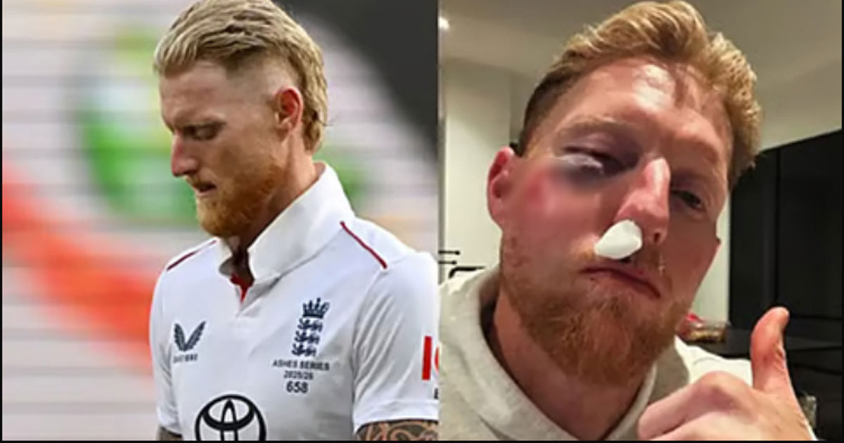 বলের আঘাতে গুরুতর আহত স্টোকসের অস্ত্রোপচার