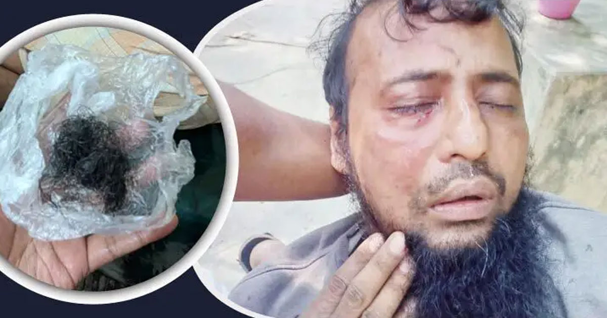 জামায়াত কর্মীকে মারধরের পর দাড়ি উপড়ে ফেললেন যুবদল কর্মী