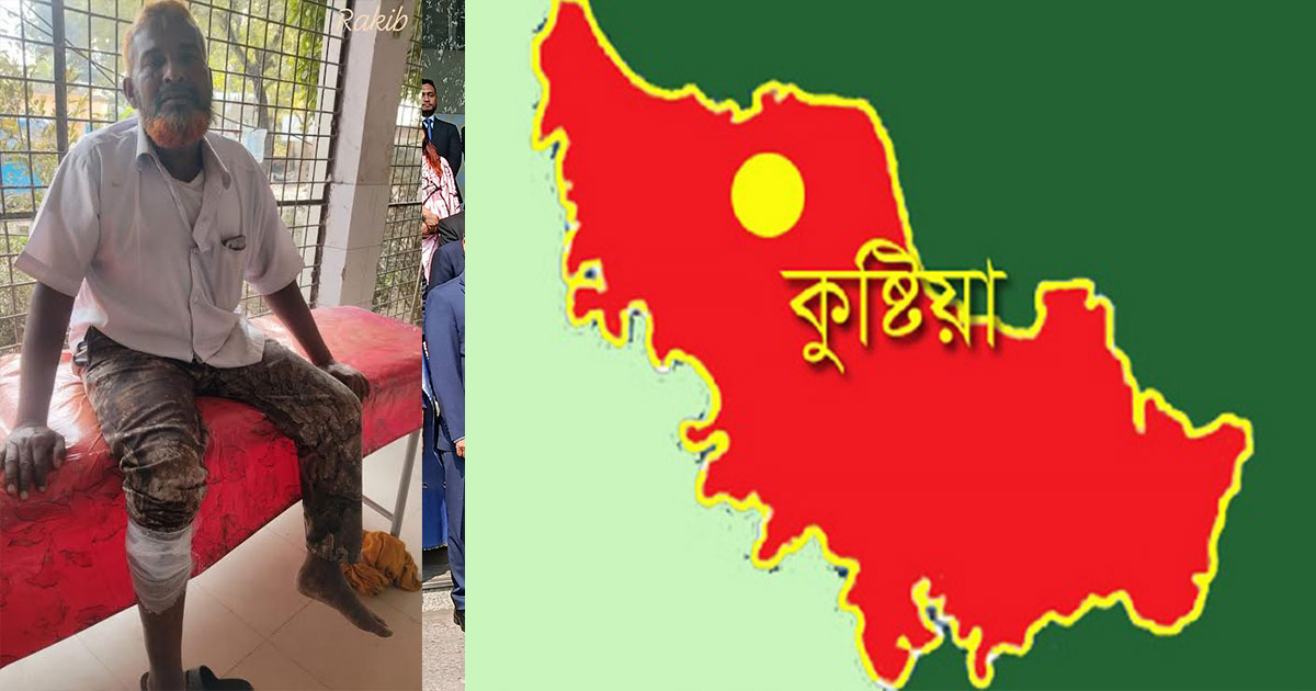 দৌলতপুরে চুরির ঘটনাকে কেন্দ্র করে দুই পক্ষের সংঘর্ষে গুলিবিদ্ধ-৩