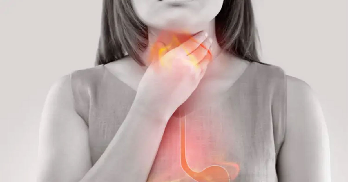 বুকে জ্বালাপোড়া? ঘরোয়া প্রতিকার জেনে নিন