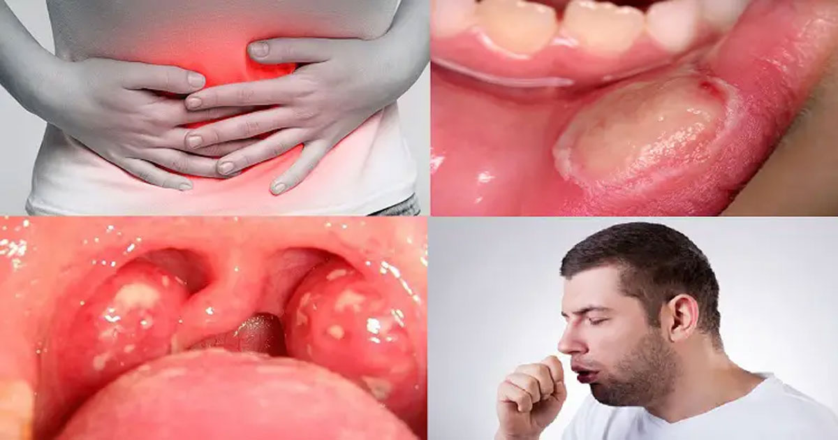 শরীরে ক্যান্সার আছে কি না? এই ১০টি সতর্ক দেখেই জানুন