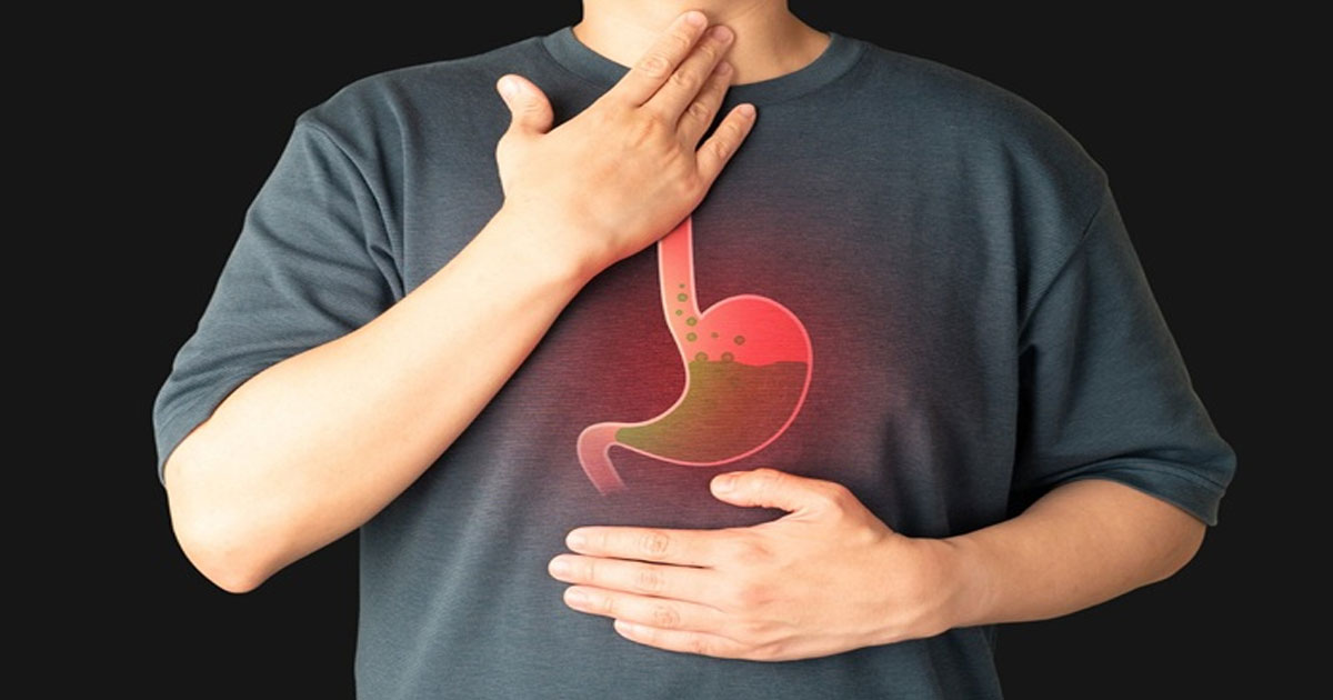 ইফতারের পর অ্যাসিডিটি? করণীয় ও খাবারের পরামর্শ