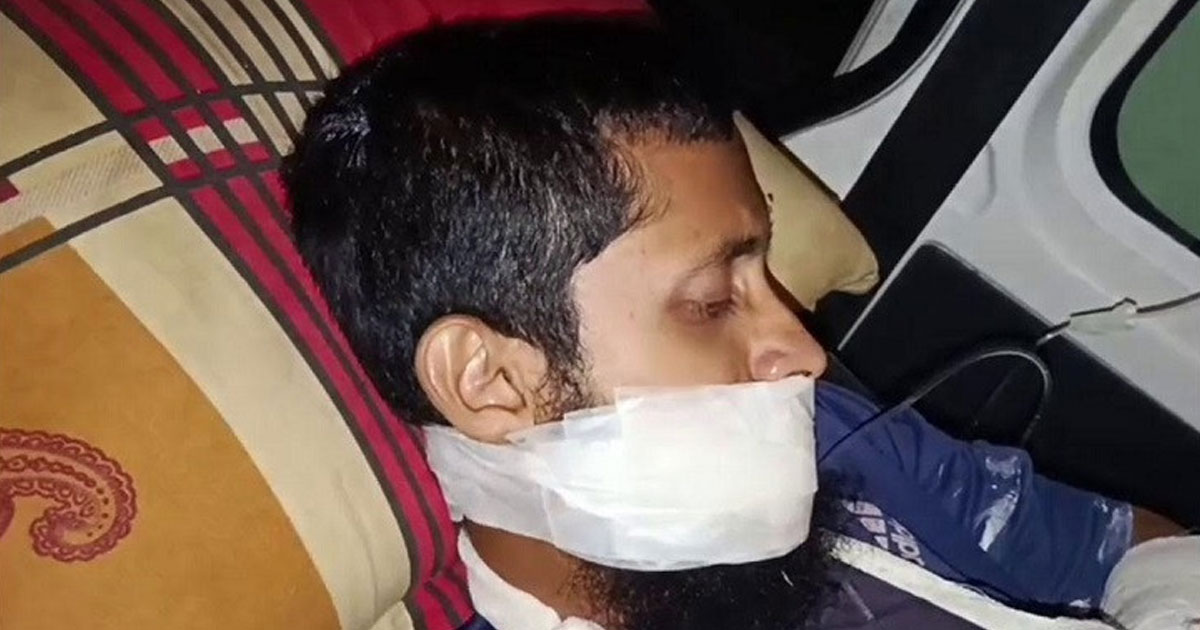 গোপালগঞ্জে ককটেল বানাতে গিয়ে যুবক আহত