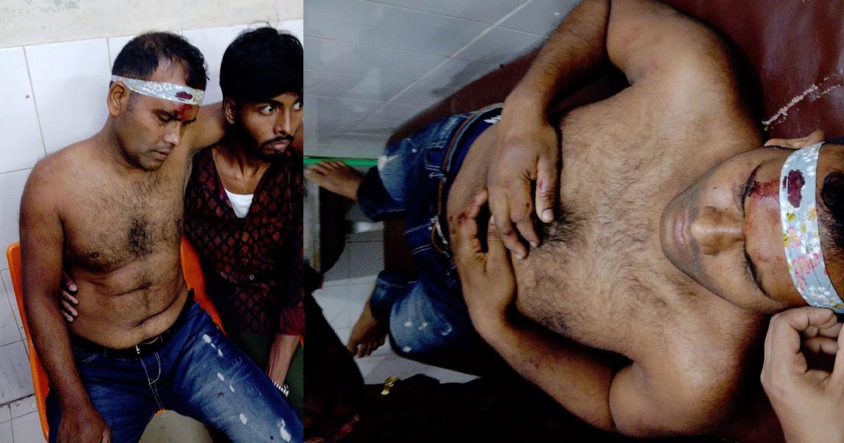 শ্রমিক দল নেতার ওপর হামলা, ২৩ জনের নামে মামলা