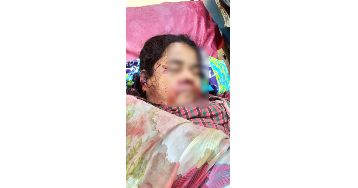 দৌলতপুরে মোটরসাইকেলের ধাক্কায় নিহত-১