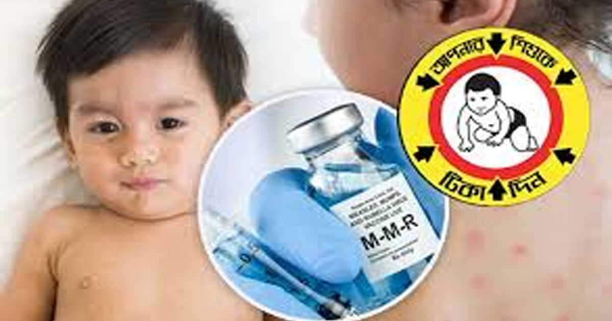 চার সিটিতে হামের টিকাদান শুরু আজ