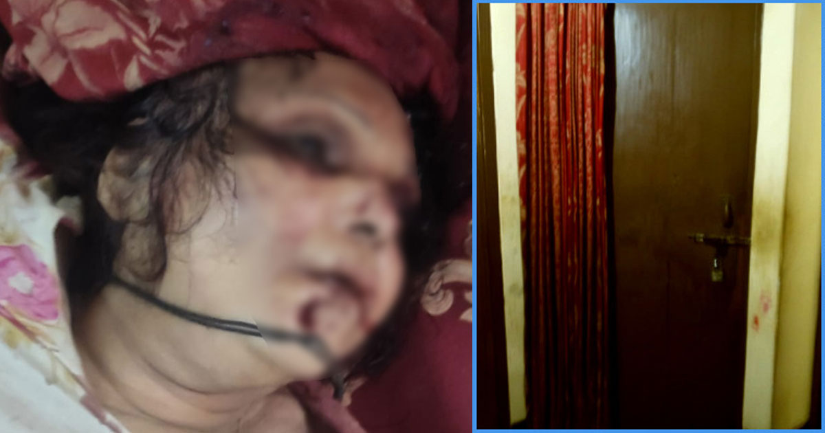 জোছনার হাতে পাওয়া চুলেই হত্যাকাণ্ডের রহস্যজট