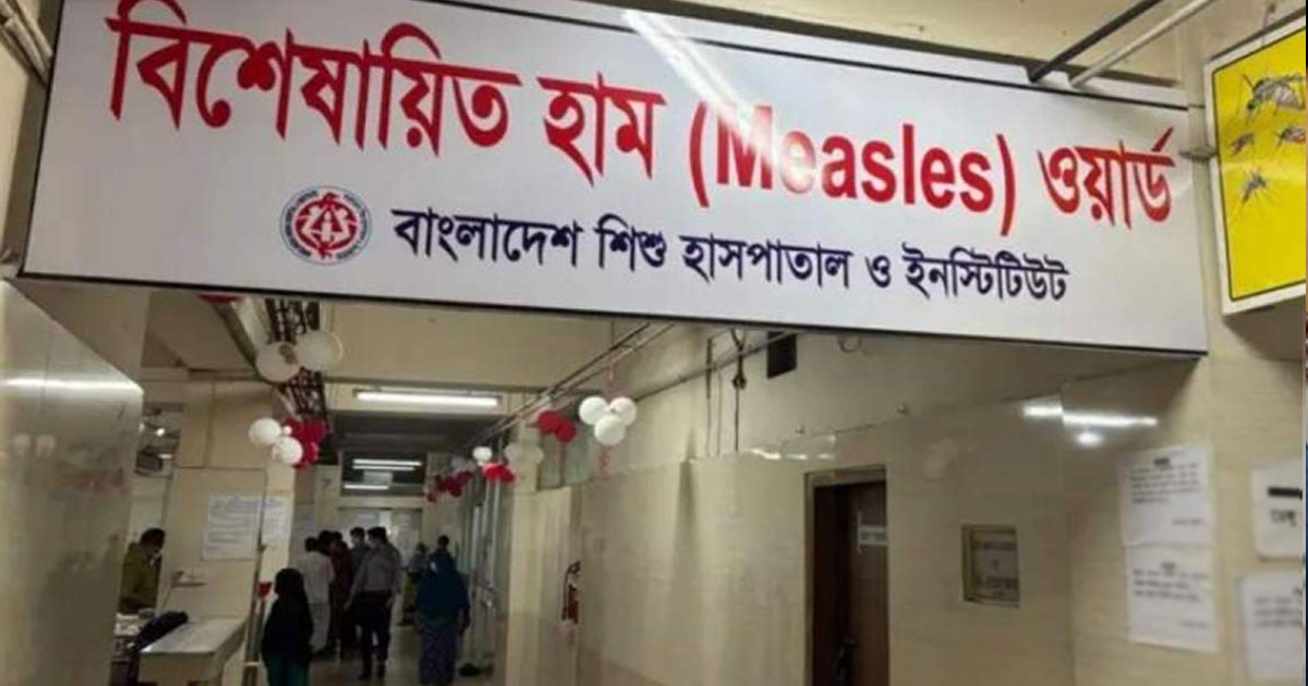 হামের উপসর্গ নিয়ে আরও ৪ শিশুর মৃত্যু