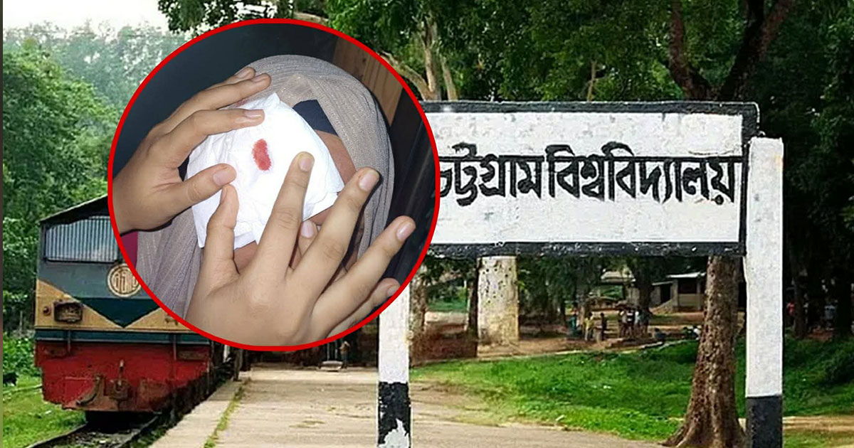 দুর্বৃত্তের ছোড়া পাথরে চবির শাটলে শিক্ষার্থী আহত