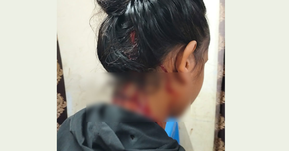 নেত্রকোণার আটপাড়ায় যৌতুকের টাকার দাবিতে গৃহবধূকে কুপিয়ে আহত