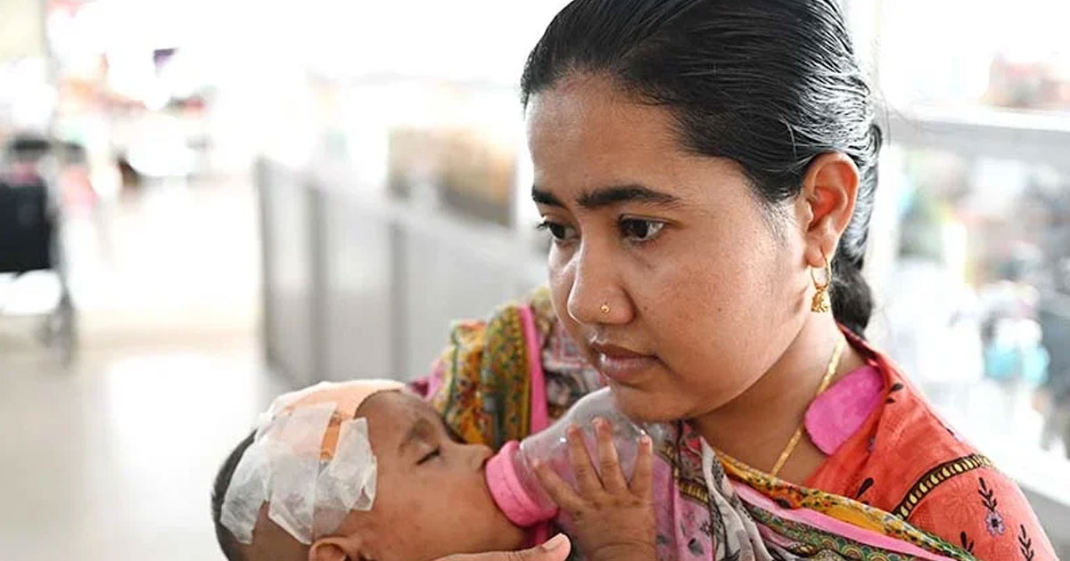 হাম ও উপসর্গে আরও ১১ শিশুর মৃত্যু