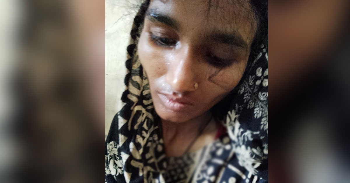 দেড় বছরের শিশুকন্যাকে গলা কেটে হত্যা করলেন মা