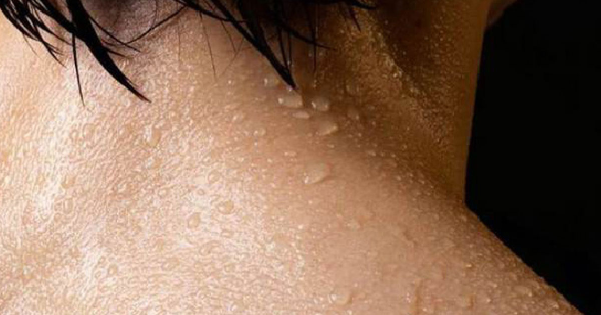 মানসিক চাপে অতিরিক্ত ঘাম হচ্ছে?