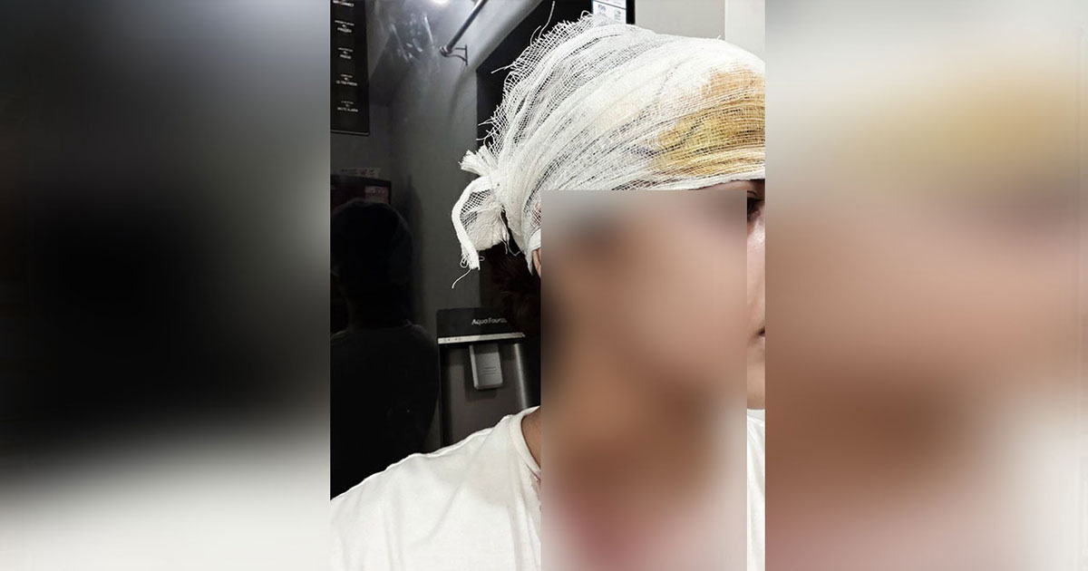 কুমিল্লায় জবি ছাত্রীকে কুপিয়ে হত্যাচেষ্টা