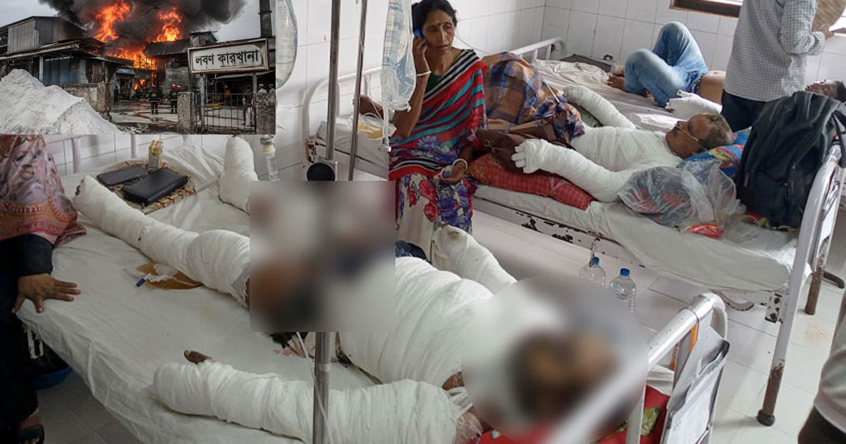 বোয়ালখালীতে লবণ কারখানায় অগ্নিকাণ্ড, ১০ শ্রমিক দগ্ধ