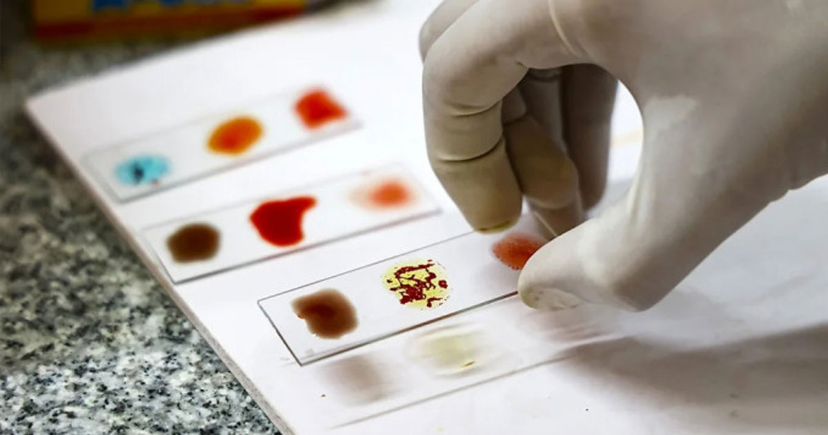 অত্যন্ত বিরল ‘গোল্ডেন ব্লাড’, বিশ্বে আছে মাত্র ৪৩ জনের শরীরে