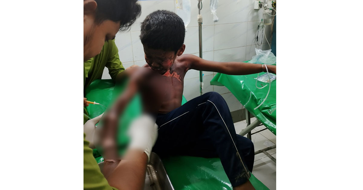 চাঁদপুরে বিদ্যুতায়িত হয়ে গুরুতর আহত শিশু