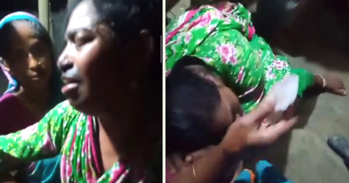 ঈদে শ্বশুরবাড়ি থেকে ছাগল না দেওয়ায় গৃহবধূকে পুড়িয়ে নির্যাতন