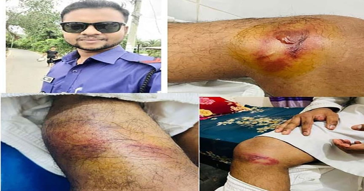 শার্শায় পুলিশ সদস্যকে হত্যাচেষ্টার অভিযোগে বিএনপি নেতাসহ ছয়জনের বিরুদ্ধে মামলা